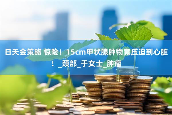 日天金策略 惊险！15cm甲状腺肿物竟压迫到心脏！_颈部_于女士_肿瘤